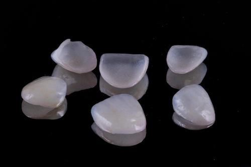 dental veneers in maple grove mn