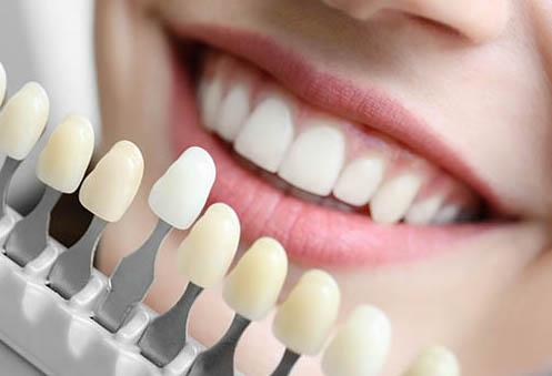 composite fillings in maple grove