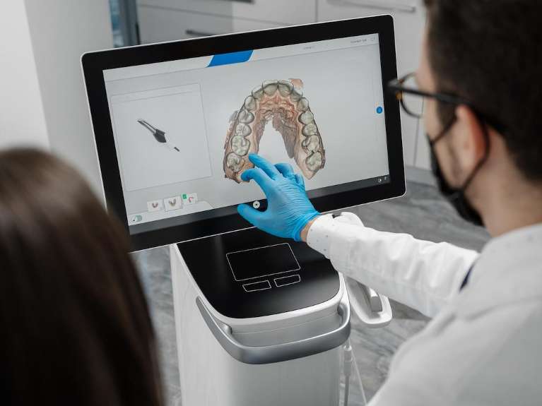 Digital Impressions at the dentist in maple grove mn